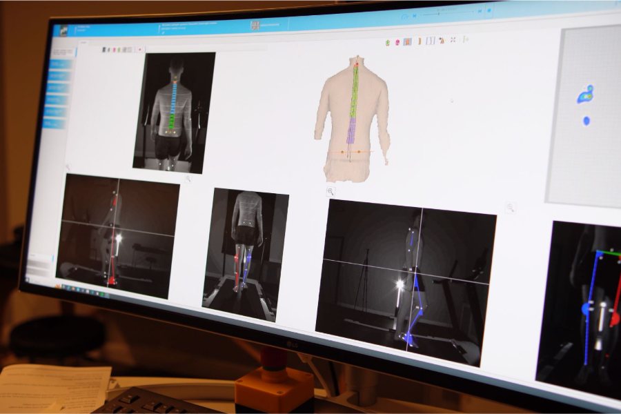 DIERS 4D gait analysis on screen
